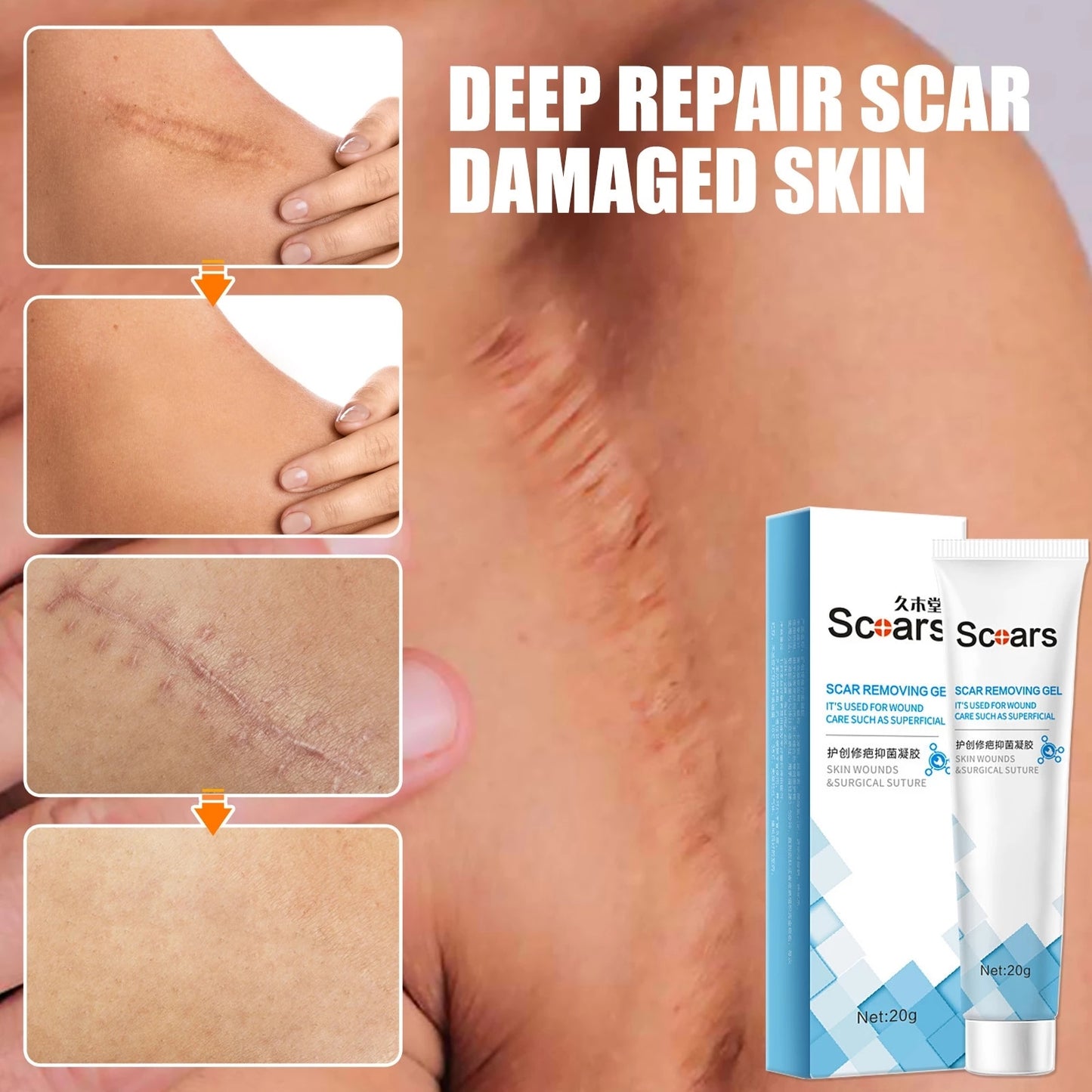 Focussa Shop™ New Herbal Scar Repair Cream