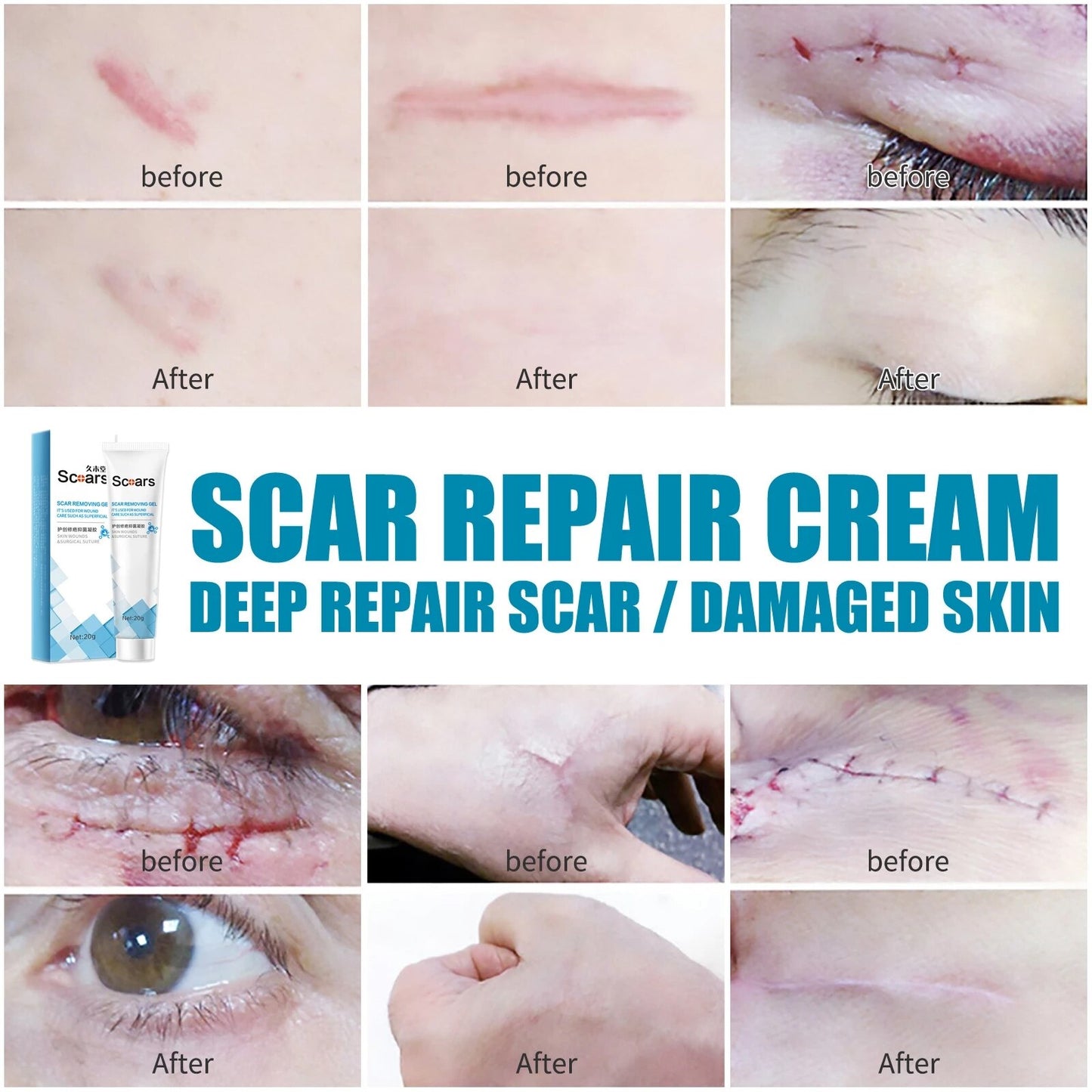 Focussa Shop™ New Herbal Scar Repair Cream