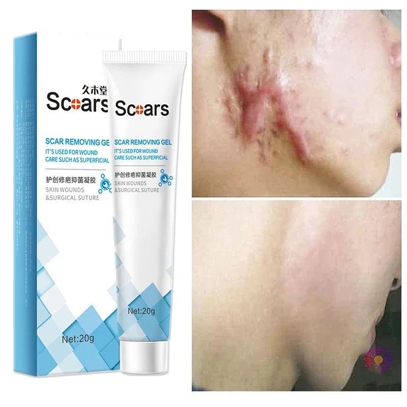 Focussa Shop™ New Herbal Scar Repair Cream