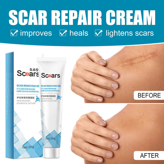 Focussa Shop™ New Herbal Scar Repair Cream